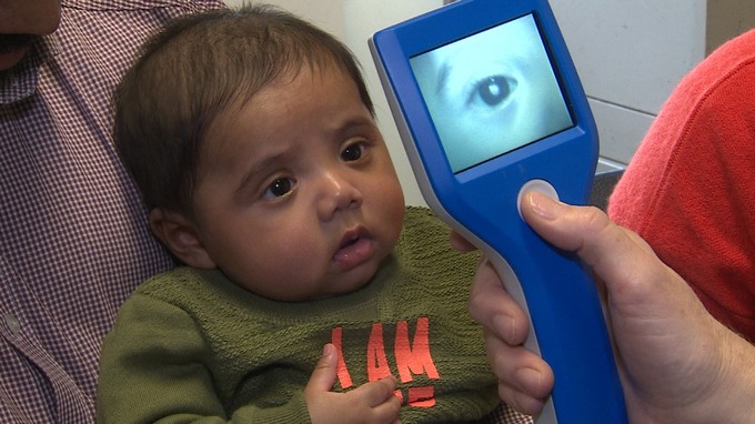 Babies can have cataracts too, ensure regular eye check-up from birth itself