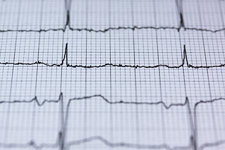 Cardiac Care 2019 and Way Forward: India has witnessed significant advancement in cardiac care with its novel surgical techniques and preventive programs